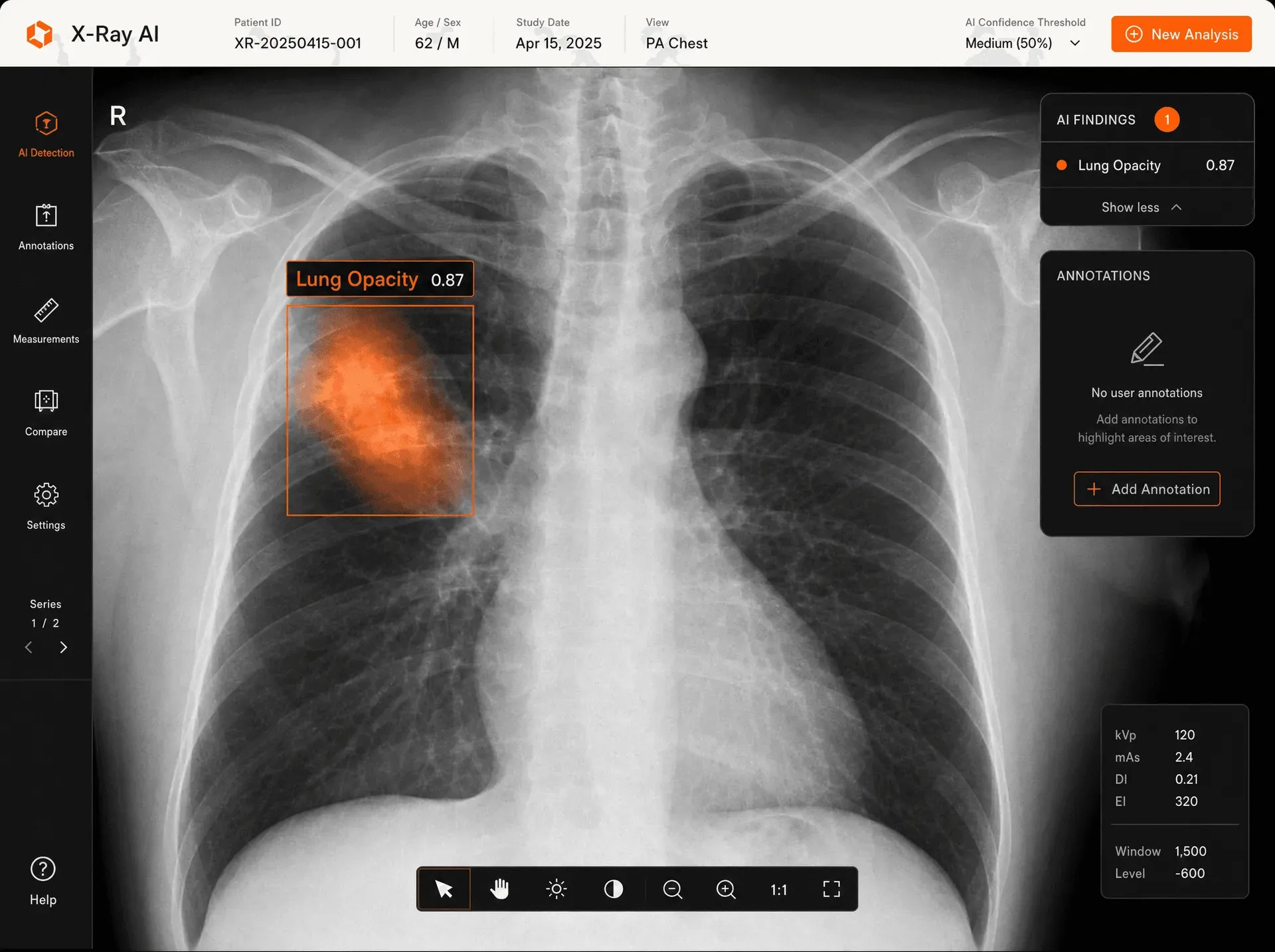 RadReport AI: Chest X-ray Reports, Ilustracja 2